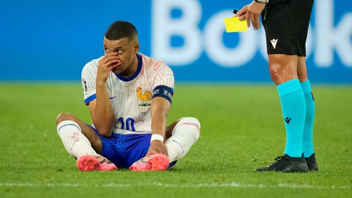 Euro 2024: France edge Austria as Mbappe suffers broken nose