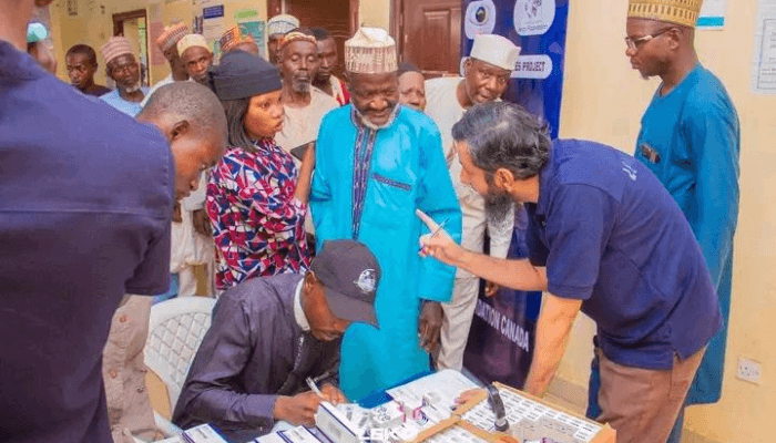 free eye service in Bauchi