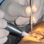 Free eye treatment