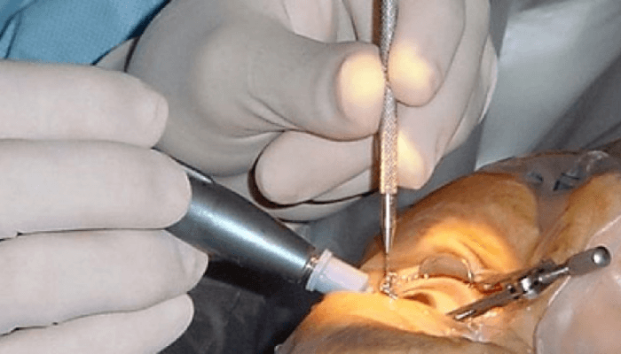 Free eye treatment