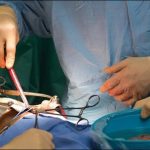 Pig organ transplant