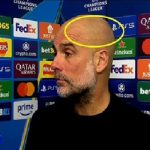 Guardiola spotted with scratches again after Man City defeat to Real Madrid