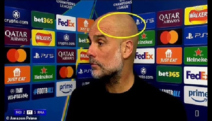 Guardiola spotted with scratches again after Man City defeat to Real Madrid