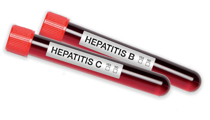 hepatitis B and C