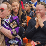 Nigerians living with albinism