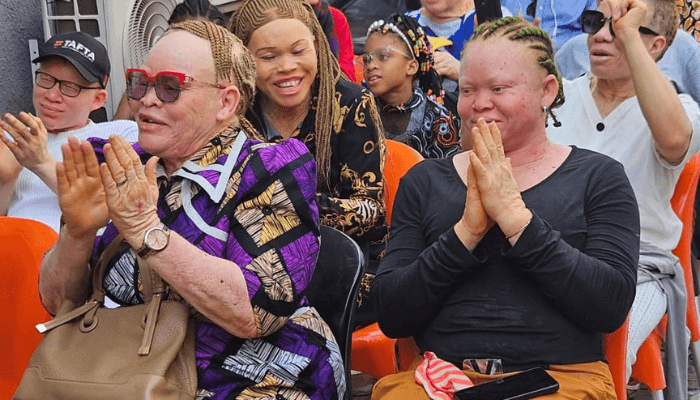 Nigerians living with albinism